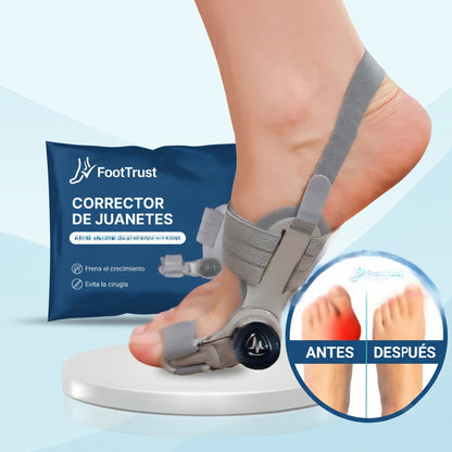 Corrector de Juanetes FootPro™