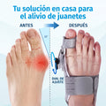 Corrector de Juanetes FootPro™