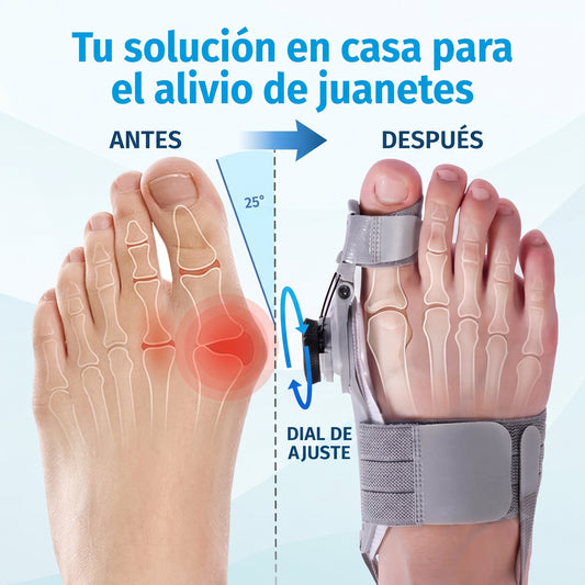 Corrector de Juanetes FootPro™